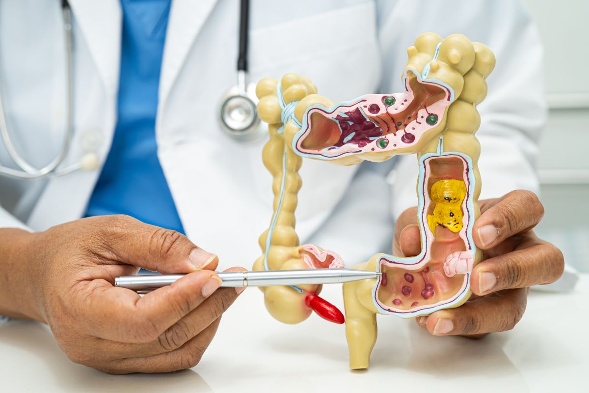 Hấp thu kém là tình trạng cơ thể không tận dụng tốt dưỡng chất từ thực phẩm, dù ăn uống đầy đủ nhưng vẫn thiếu năng lượng và dinh dưỡng.